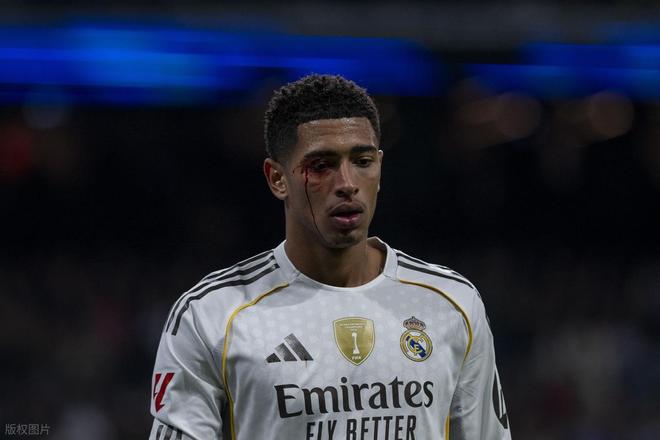 遭遇皇马球员背叛，阿隆索心灰意冷，穆里尼奥紧急救火？