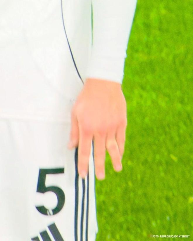 富勒姆后卫安诺生比赛中手指脱臼，队医给他复位时他都不敢看